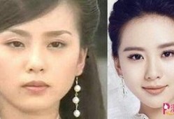 娱乐圈爆料整容,明星整容真相大揭秘！